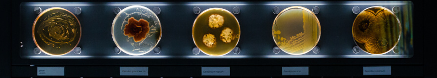 Agar Plates with Bacteria Black Background